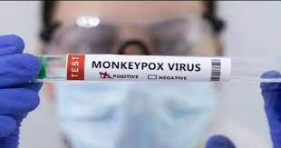 (monkeypox):